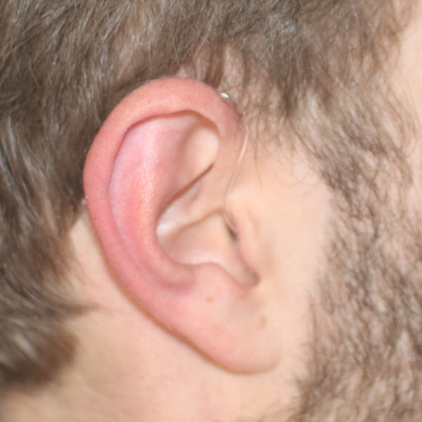 Audionexx 202 Hearing Aid